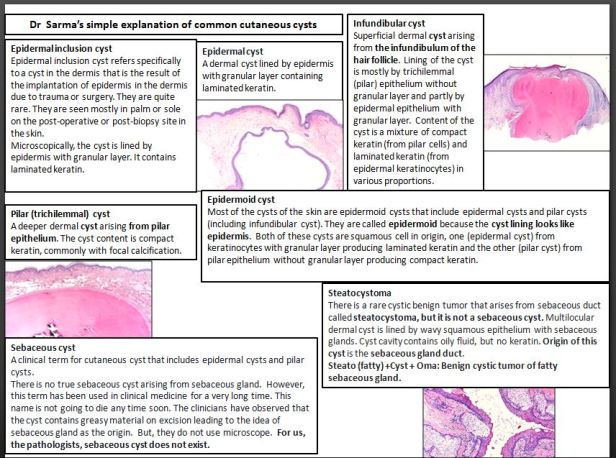 Cutaneous cysts